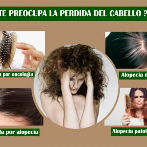 Aceite esencial para el crecimiento del cabello Previene la pérdida de cabello prematuro. Promueve el crecimiento del cabello sano. Logra que nazca cabello nuevo más fuerte y repara nutriendo los cabellos rotos
